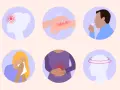 Symptômes d'une allergie : maux de tête, éruption cutanée, toux, éternuements, douleurs abdominales, vertiges. Peut-être une allergie au maquereau.