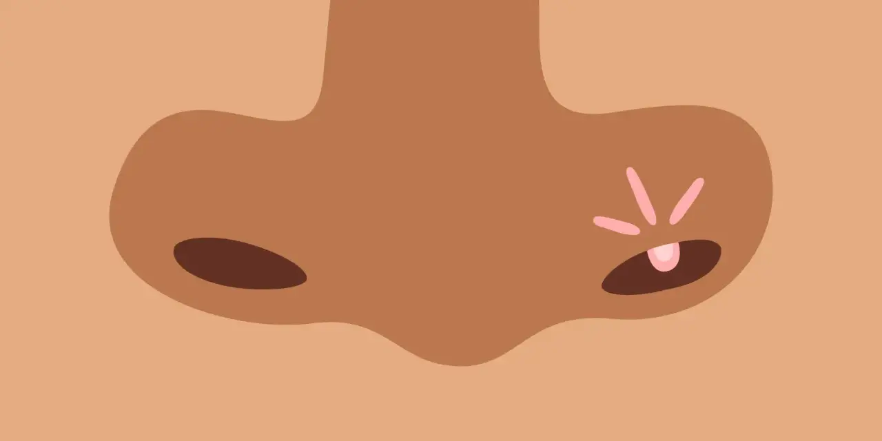 Un bouton de fièvre sur le nez, un remède de grand-mère pour le faire disparaître.