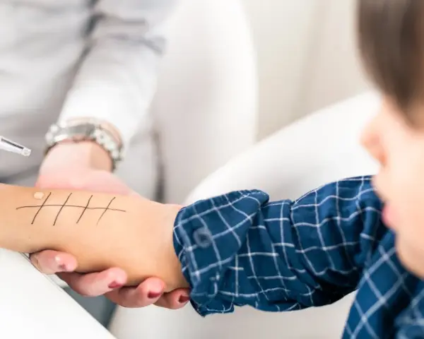 Un enfant subit un test cutané pour diagnostiquer une allergie chataigne. Des gouttes sont appliquées sur son bras marqué de lignes.