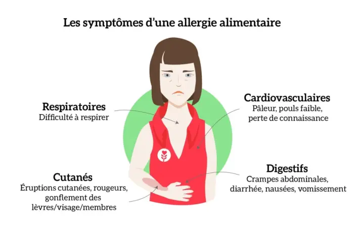 Une personne souffre de symptômes d'allergie alimentaire, incluant urticaire et diarrhée, avec des indications sur les réactions cutanées, digestives, respiratoires et cardiovasculaires.