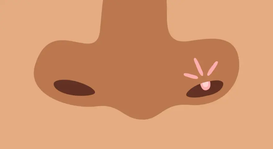 Un bouton de fièvre sur le nez, un remède de grand-mère pour le faire disparaître.
