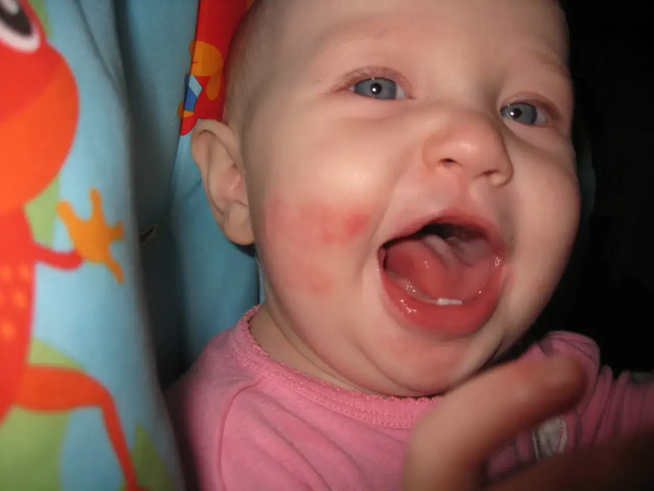 Bébé riant avec des rougeurs sur la joue, peut-être une réaction à une kiwi allergie.